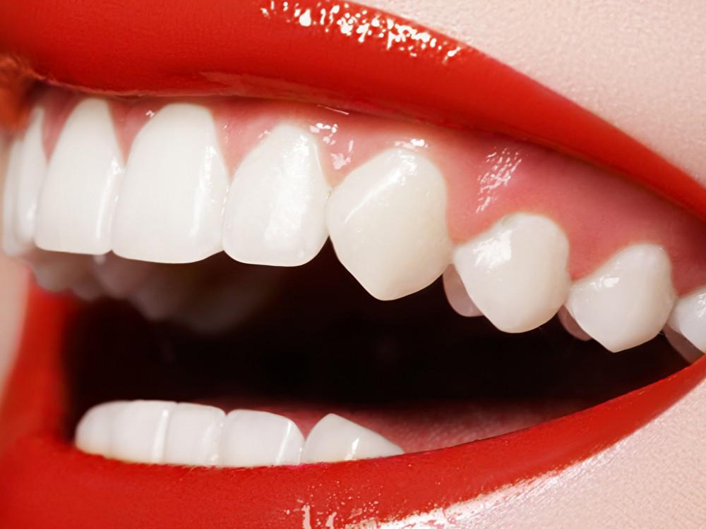 Clareamento dental pode mudar seu sorriso para melhor e nada se compara a um belo sorriso com dentes brancos e bonitos para abrir portas para você.